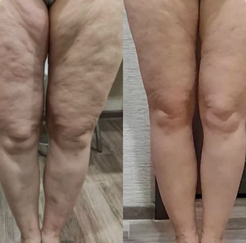Real improvement in 4 weeks