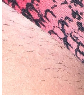 Before image 1