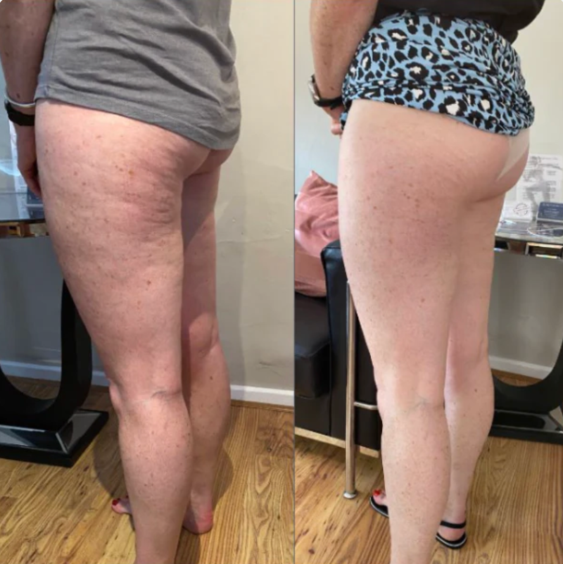 My legs look so much better